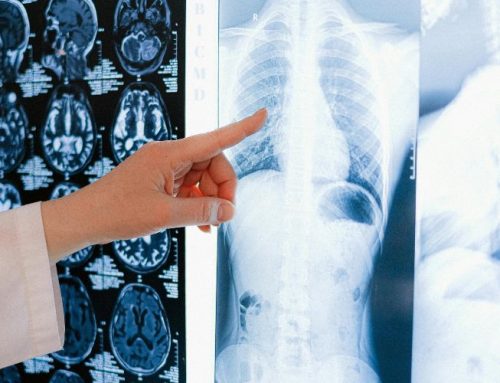 Why an Age of Injury Analysis Should Be the Starting Point in Claims Management